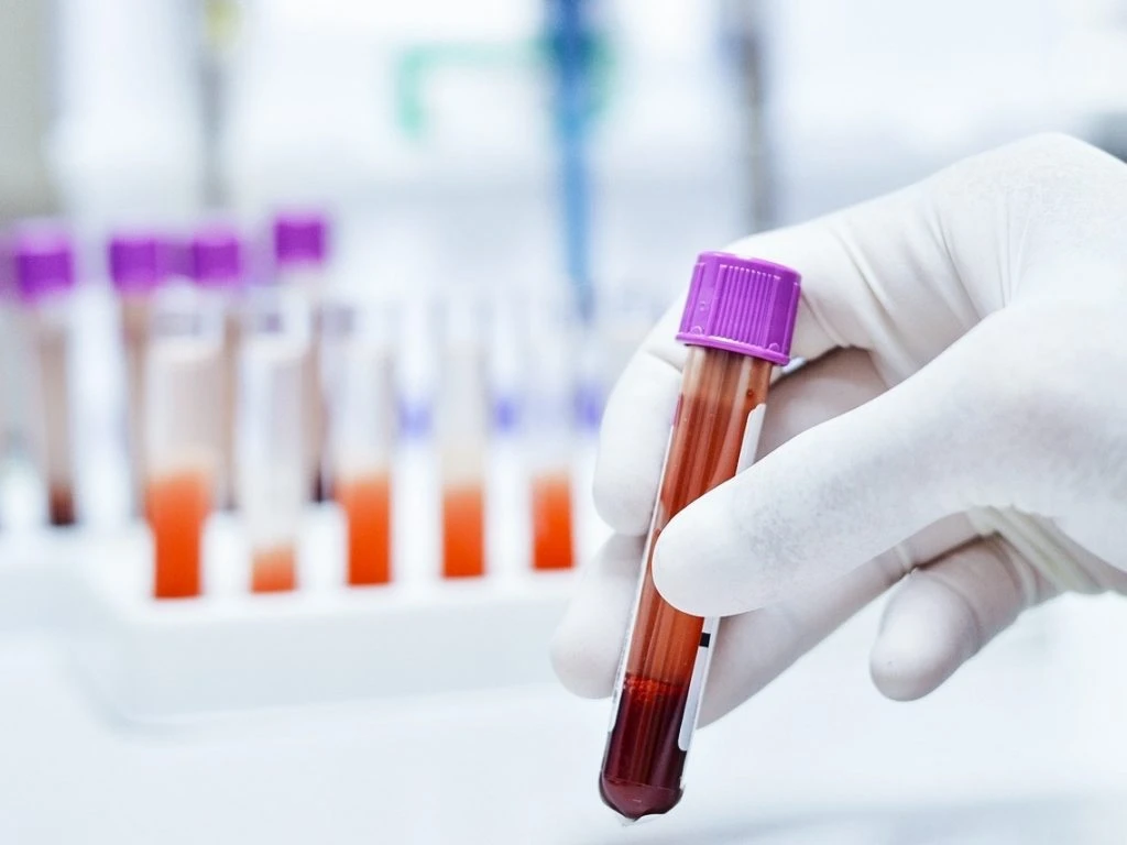 Painel de DSTs: prevenção, diagnóstico e cuidado com a saúde