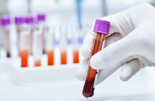 Painel de DSTs: prevenção, diagnóstico e cuidado com a saúde