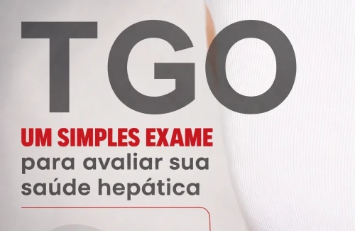 Exame TGO: por que ele é importante para a sua saúde?