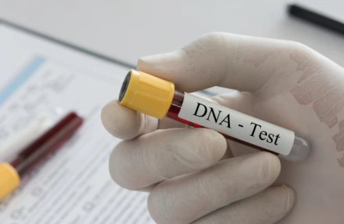 Exame de DNA para confirmação ou exclusão de paternidade