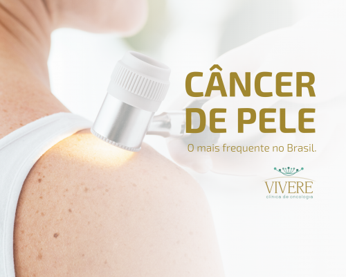 Câncer de Pele - O Mais Frequente no Brasil