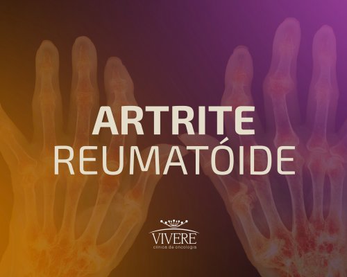 Artrite reumatoide: sintomas e formas de tratamento