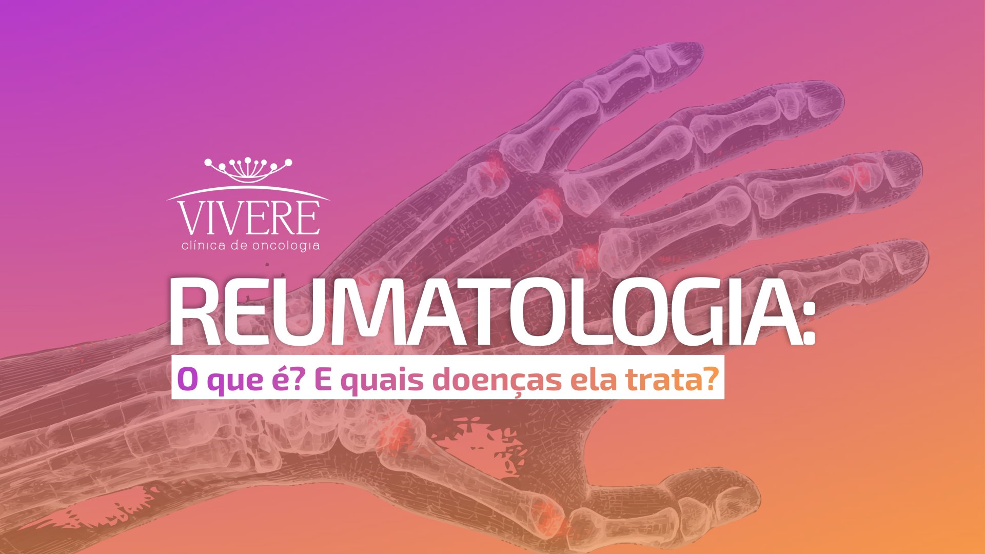 Reumatologia: o que é e quais doenças trata
